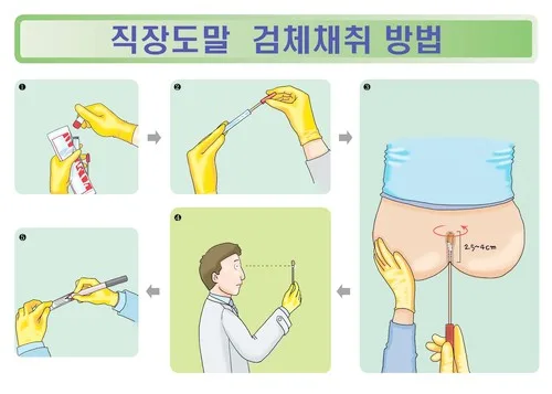 “항문 검사요?” 보건증 검사 민망하다는 사람들을 위한 현실 팁 2 보건증 항문검사 예시 이미지